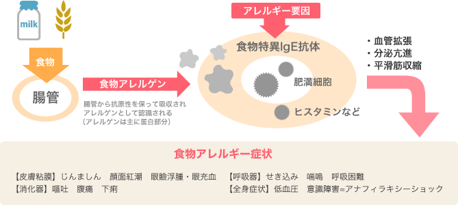 食物アレルギー症状